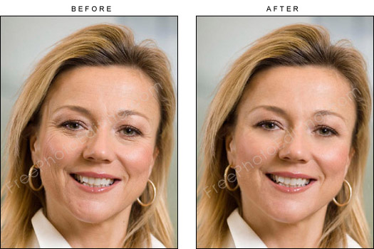 This is a photo editing example of a woman who has been administered digital Botox cosmetic procedure for a more youthful look
