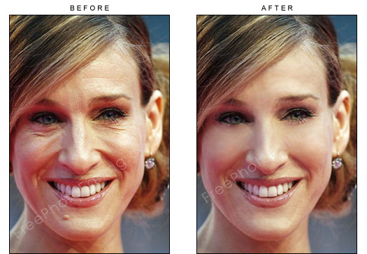 This is a photo editing example in which 'Sex and the City' TV series actress, Sarah Jessica Parker has been digitally retouched to look younger. Lines on the forehead have been removed. Wrinkles under the lines have been touched up. 
