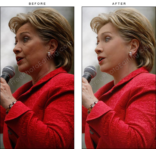 This is a photo retouching example in which Hillary Clinton has been given a virtual facelift to look younger. Now there are no wrinkles, sagging skin has been corrected and forehead lines have been removed.