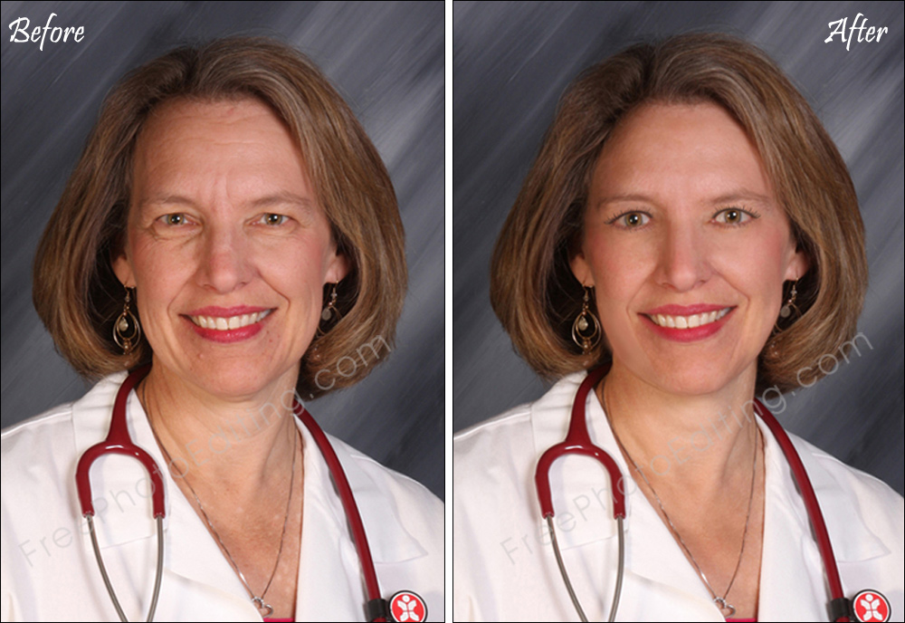 This is a beauty retouching example of a woman made to look young with digital skin treatment. No surgery or Botox is involved. Original, unedited photo can be seen on left.
