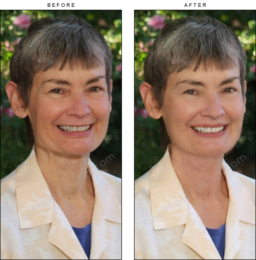 A virtual wrinkle-reduction alternative is photo retouching. View 'before' and 'after' versions of a mature woman who looks young with photo editing.