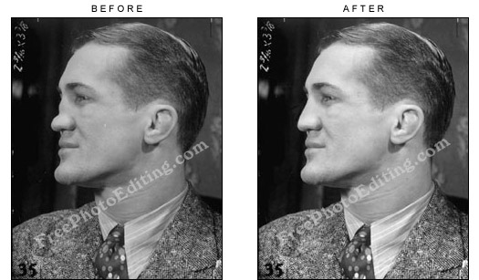 Fritzie Zivic's broken nose has been fixed with photo editing -- a digital nose job -- virtual rhinoplasty.