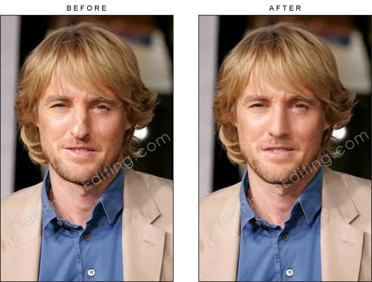 This is a photo editing example of nose correction in which Owen Wilson's broken nose has been fixed with digital corrective surgery.