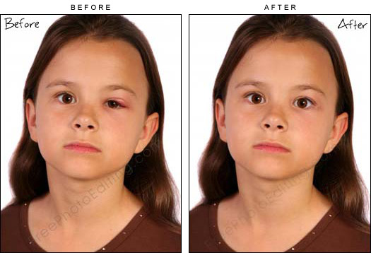 Eye correction services provided by photo retouching experts