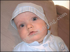 Squint eye correction carried out on baby with photo editing