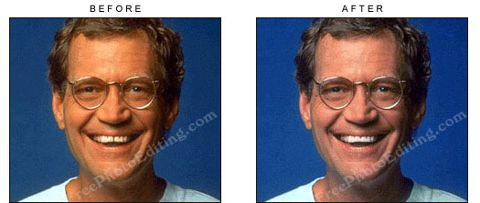Teeth gap between David Letterman's front teeth has been bridged with photo editing (digital cosmetic dentistry).