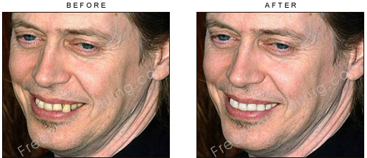 This is a retouched photo is which Steve Buscemi's snaggle tooth has been corrected. The original photo can be seen on left.