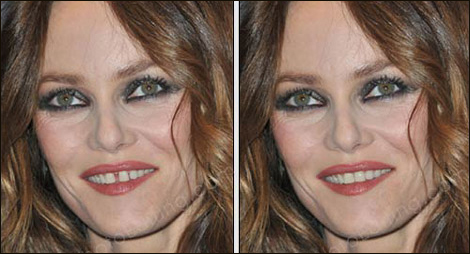 Photo retouching example of teeth gap correction. Vanessa Paradis