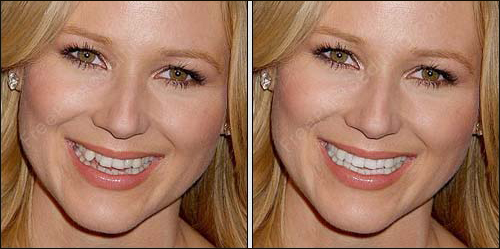 Celebrity teeth correction with photo editing. Straighten Jewel Kilcher