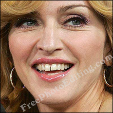 Photograph shows unsightly gap between pop singer Madonna's front teeth