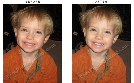 Teeth Whitening – Whiten your teeth in photos