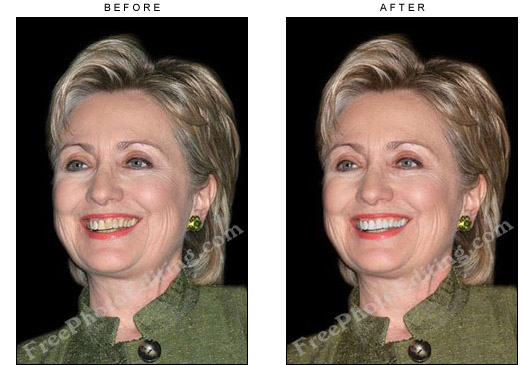 Hillary Clinton's yellow teeth have been whitened with the use of photoediting