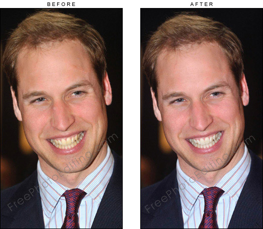 Prince William's teeth in photo have been whitened by retouch artists. The original photo showing the Prince's yellowing teeth can be seen on left.