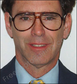 This is a photo editing example of straightening out a crooked, lopsided smile. Also, the subject's glasses have been touched up, so that they don't look like bifocals.