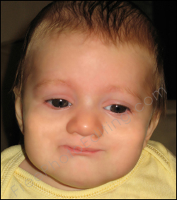 This is a photo editing and photo retouching example of baby care! A crying baby has been converted to a happy baby. Sad facial expressions have been changed to happy expression.
