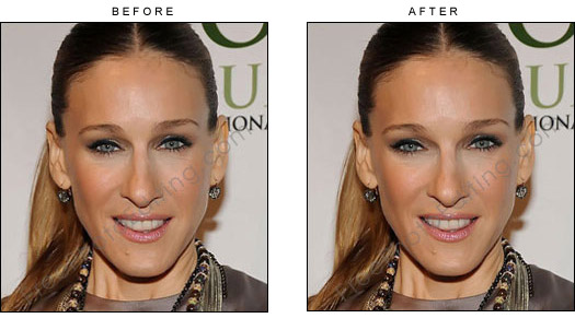 The gap between Sarah Jessica Parker's close-set eyes has been widened. View original photo on left.